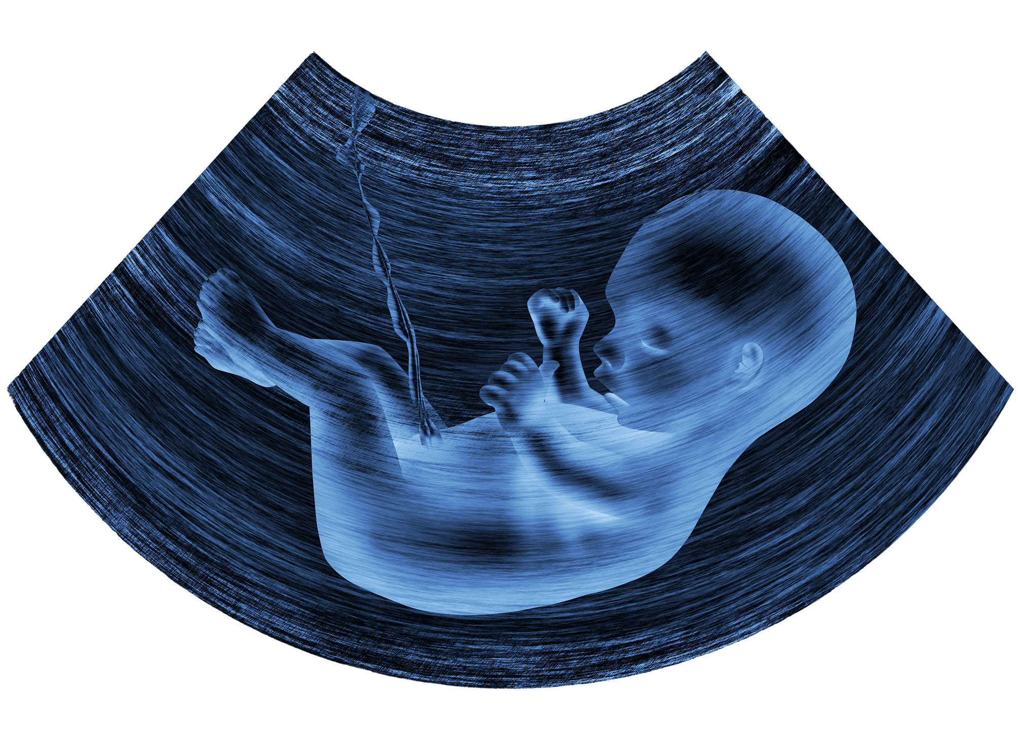 Upload Your 4D Ultrasound